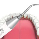 드림탑치과 | 상봉역잇몸치료 전반적인 구강 관리를 위해