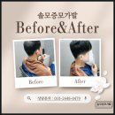 고객공유 | 부산남자부분가발 | 앞머리·정수리 탈모 증모술로 한번에 해결한 고객님 후기 공유합니다