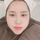 위드프러스타워 | 부천피부관리실 미네에스테틱에서 스킨부스터 받고 온 찐후기