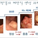 대장암 위험을 낮추는 식품 이미지