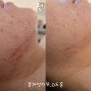 예쁨에물들다 네이버블로그