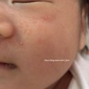 화장품총판 | 아기 태열 관리 후기, 내돈내산, 몽디에스 수딩젤, 시카리페어크림, 쁘리마쥬 고보습 크림, 약모밀...