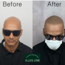 일러스라인 이미지