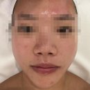 에끌라영에스테틱 | 광주 일곡동 피부관리 에끌라영에스테틱 콜드플라즈마 맞춤 케어로 맑아진 피부 톤업 후기