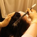 웰킨마포점 | [웰킨] 탈모의 골든타임?! 시작 시기가 중요합니다