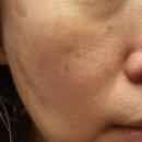 21 | 다이소 마데카 21 잡티 크림 내돈내산 후기