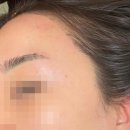 GS25 연제브라운점 | 부산 연산동 왁싱 태닝 앤바디뷰티 솔직후기 PDT진정관리 받고 피부결 달라진 솔직후기