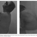 Thoracic spine : 흉추의 해부, 생체역학을 고려한 manual therapy 1997년 이미지