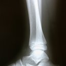 초이스병원 이미지