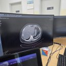 서울특별시 서울의료원 | [비만대사수술 3편] 초진 전 검사와 서울의료원 초진 상담 후기