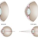 투에이치 안경 이미지
