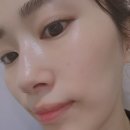 디샤인의원 | [대림역 피부과_디샤인의원] 영등포 피부과 추천, 스킨보톡스 후기