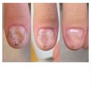 더네일에스샵(The Nail S#) | 목동물어뜯는손톱 습관 고치고 싶다면 여기! 네일샵에스 아를솔즈(문제성손톱 관리 후기)