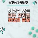 피부묘기증 원인과 증상 치료방법 이미지