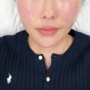 아미뷰티아카데미 | 대구 대명동 아미뷰티아카데미 티리온X 후기｜한 번 받고 또 와버린 리프팅 클래스👍🏻