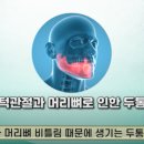 캘리포니아미형 이미지