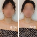 백운역 고객화장실 | 부평 에스테틱 유리햅에스떼 윤곽과 체형을 동시에!