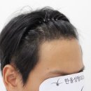 더헤어라인성형외과의원