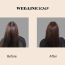 위라인(WEE:LINE) 이미지
