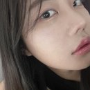 에디션성형외과의원 | 수면엑소좀 강남엑소좀 효과 후기 대박만족 스럽네요 /홍조 예민성 피부