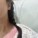 더웰병원 | [수원/영통 더웰병원] 편도절제 수술 후기(+코블레이터)