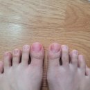 네일판다몰범계점 | 셀프페디:: 아크릴연장, 파우더네일, 건대 판다몰, 한포진 근황