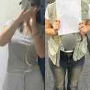 푸디스트(주) 수원중앙병원점 | 수원 광교 다이어트 성공후기 많은 병원 지방분해주사 4주차 후기
