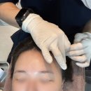 (주)은빈개발 | 안양 탈모 치료 병원 원형 탈모 관리 후기