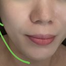 4682 | |부산 해운대 윤곽관리, 피부관리, 물광관리 추천| 해운대에스테틱으로 다녀온 스킨케어 중 윤곽 케어 후기