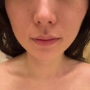 중계본동주민센터 주민참여방(2층) | 청담경락관리 돌출된광대케어 위뷰티 청담점 후기