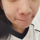 케이엠스토어 | 마곡피부관리실 케이엠 에스테틱 마곡점 아크네 관리 후기