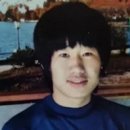 최양락 모발 이식 비용은 얼마? 절개와 비절개 차이 총정리
