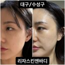 리자스킨엔바디(수성점)