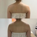 차랑차랑 | 창원 282에스테틱 웨딩 드레스핏 관리, 테라노바 등•승모근 3회차 후기