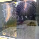 생활속의 H | H리셀오산대역점 오산탈모관리 솔직후기!