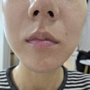 분당 정자동 모공관리 피부 관리실 올뉴뷰티