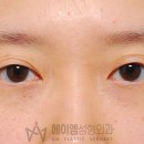 풀림
