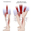 누가정형외과의원 이미지