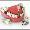 스타28치과의원 | 장안동치과 일산스타28치과의원