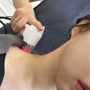 헤이메이 | 합정미용실 헤이메이 두피리프팅으로 작은얼굴 된 후기
