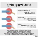 부산아이센터안과의원 이미지