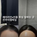 효자동 전주이엠왁싱 헤어라인 인중 왁싱 후기