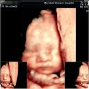 이선주 | [강서미즈메디] 26주 임신성 당뇨검사 133인데 재검 후기입체초음파 이선주 선생님