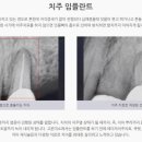 모두의미소치과의원 네이버블로그