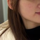 리엔 | ✨리엔 에스테틱 PLAJET PRO 체험 후기✨