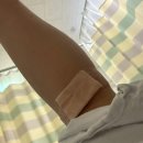 엘에스한방병원 | 리스프랑 인대파열, 전거비인대파열 수술후기(D+8)