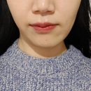 통영장치과의원 | 이갈이 치과 치료 후기, 5곳 방문 후 알게 된 점