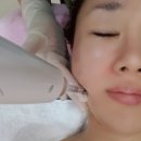 창원 리프팅 &#39;미시안뷰티뱅크&#39; 팔자주름관리 후기!