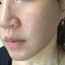 라뮤헬스케어 | 반코르 리리힐 고주파마사지기 갈바닉 장단점/타사제품 스펙 비교 &amp; 매일사용하며 피부가꾸기!