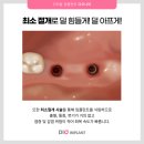 디오컴퓨터 이미지